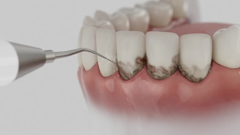 Reliable Dental contractor in Visalia, CA by Smile Center Dentistry